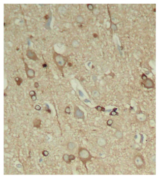 Anti-Phospho-MAPT-S396 Antibody (CABP0163)