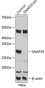 Anti-SNAP29 Antibody [KO Validated] (CAB19952)