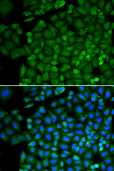 Anti-SELENBP1 Antibody [KO Validated] (CAB1222)