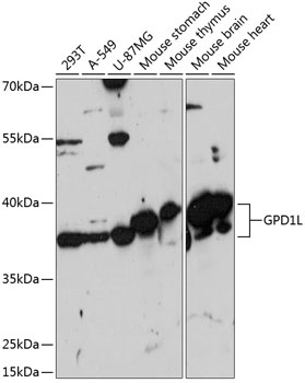 Anti-GPD1L Antibody (CAB14392)