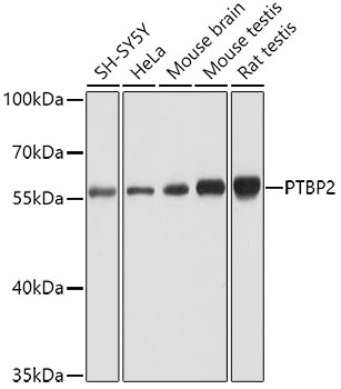 Anti-PTBP2 Antibody (CAB6054)