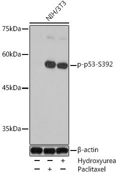 Anti-Phospho-TP53-S392 pAb (CABP0860)