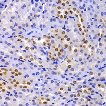 Anti-CBX5 Antibody (CAB12592)