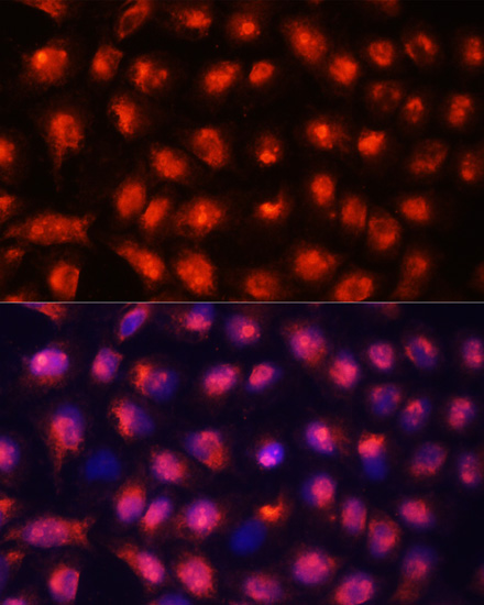 Anti-ACYP1 Antibody (CAB15021)