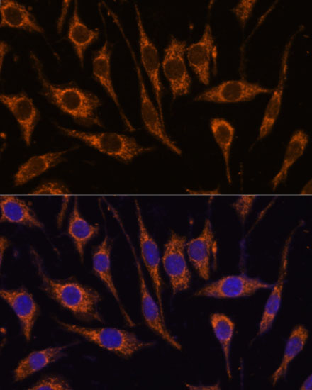 Anti-CCDC6 Antibody (CAB16075)