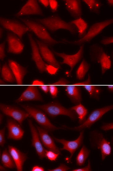 Anti-Smad4 Antibody (CAB5657)