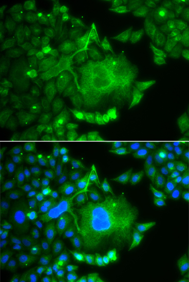 Anti-CACNG4 Antibody (CAB14118)