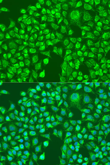 Anti-DLG4 Antibody (CAB6194)