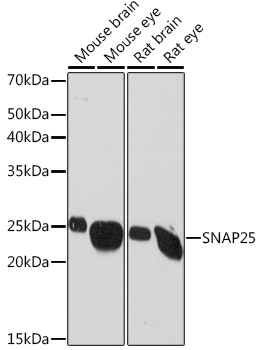 Anti-SNAP25 Antibody (CAB2234)