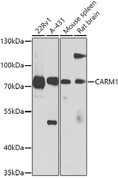 Anti-CARM1 Antibody (CAB2246)