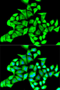 Anti-CD22 Antibody (CAB5790)