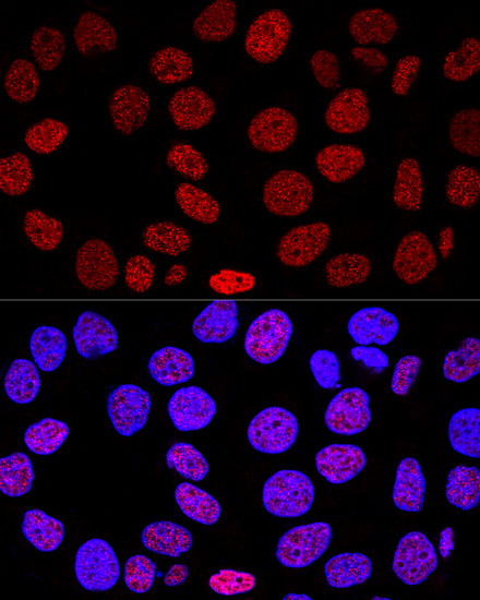 Anti-Histone H2AX Antibody (CAB2082)