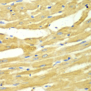 Anti-OGT Antibody (CAB2214)