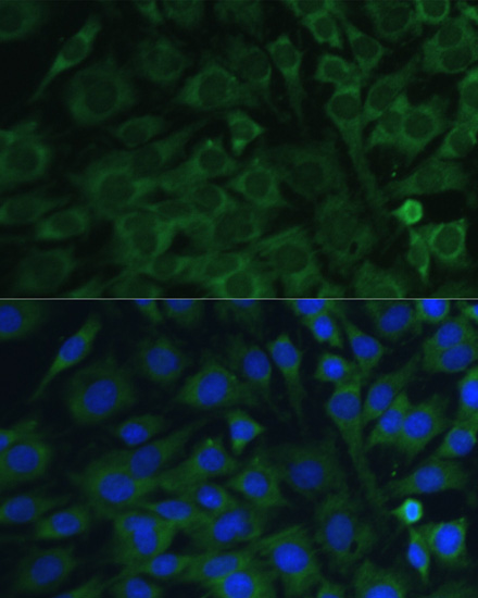 Anti-OSM Antibody (CAB6163)