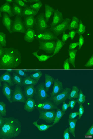 Anti-MLH3 Antibody (CAB7796)