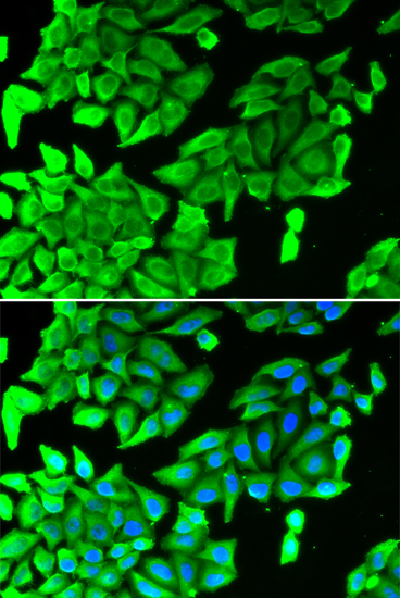 Anti-JNK1 Antibody (CAB2985)