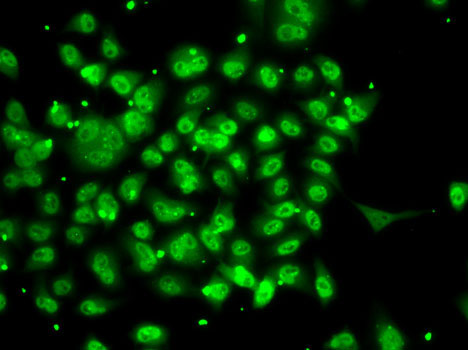 Anti-SMYD3 Antibody (CAB7309)