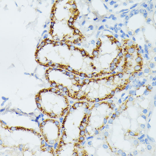 Anti-ETHE1 Antibody (CAB10142)