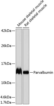 Anti-Parvalbumin Antibody (CAB19098)