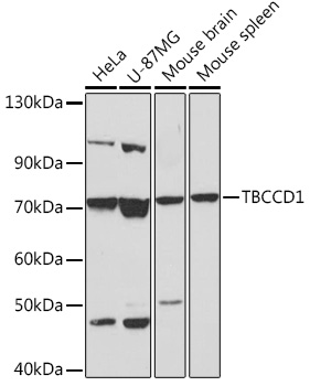 Anti-TBCCD1 Antibody (CAB18143)