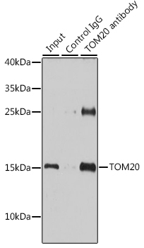 Anti-TOM20 Antibody (CAB6774)