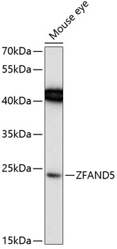 Anti-ZFAND5 Antibody (CAB13185)