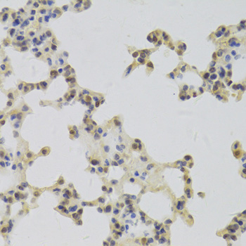 Anti-HDGF Antibody (CAB5347)