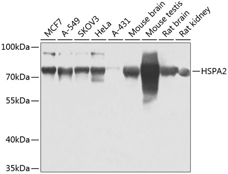 Anti-HSPA2 Antibody (CAB7902)