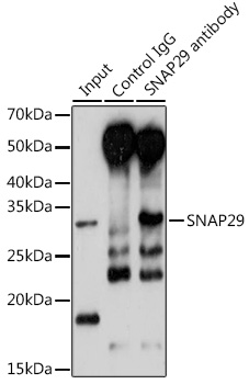 Anti-SNAP29 Antibody (CAB4290)