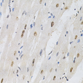 Anti-KPNA4 Antibody (CAB2026)