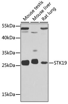 Anti-STK19 Antibody (CAB13383)