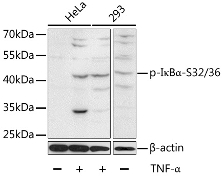 Anti-Phospho-I kappa B alpha-S32/36 Antibody (CABP0614)