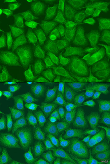 Anti-BAG2 Antibody (CAB7763)