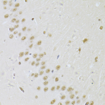 Anti-SNRPA Antibody (CAB6410)