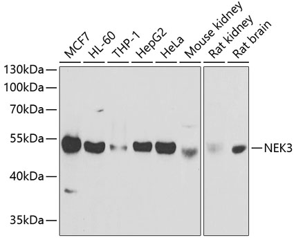 Anti-NEK3 Antibody (CAB6665)