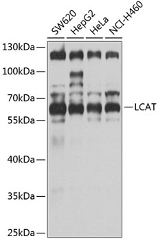 Anti-LCAT Antibody (CAB3942)