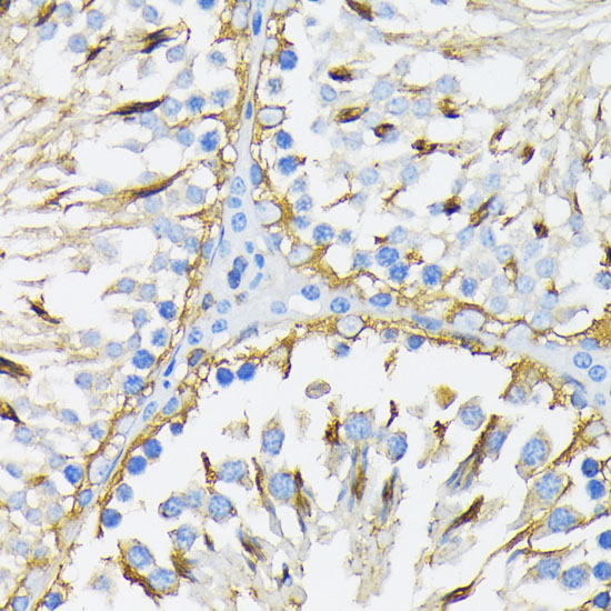 Anti-HSP90B1 Antibody (CAB0989)