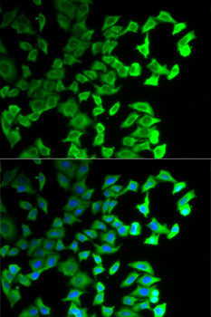 Anti-DIAPH1 Antibody (CAB5772)