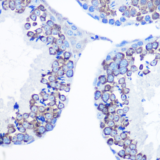 Anti-DDX4 Antibody (CAB15624)