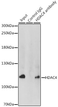 Anti-HDAC4 Antibody (CAB0239)