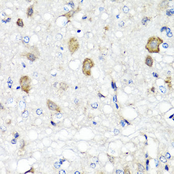 Anti-RBP2 Antibody (CAB6717)