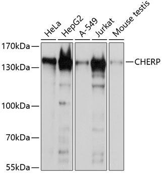 Anti-CHERP Polyclonal Antibody (CAB9702)