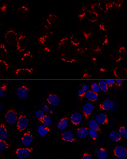 Anti-GOLM1 Antibody (CAB7283)