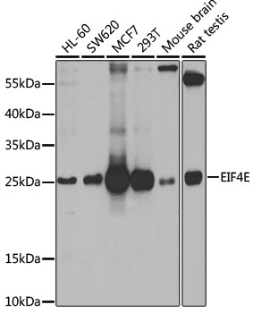 Anti-EIF4E Antibody (CAB2162)