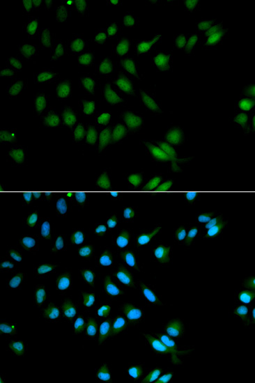 Anti-XRCC2 Antibody (CAB1800)