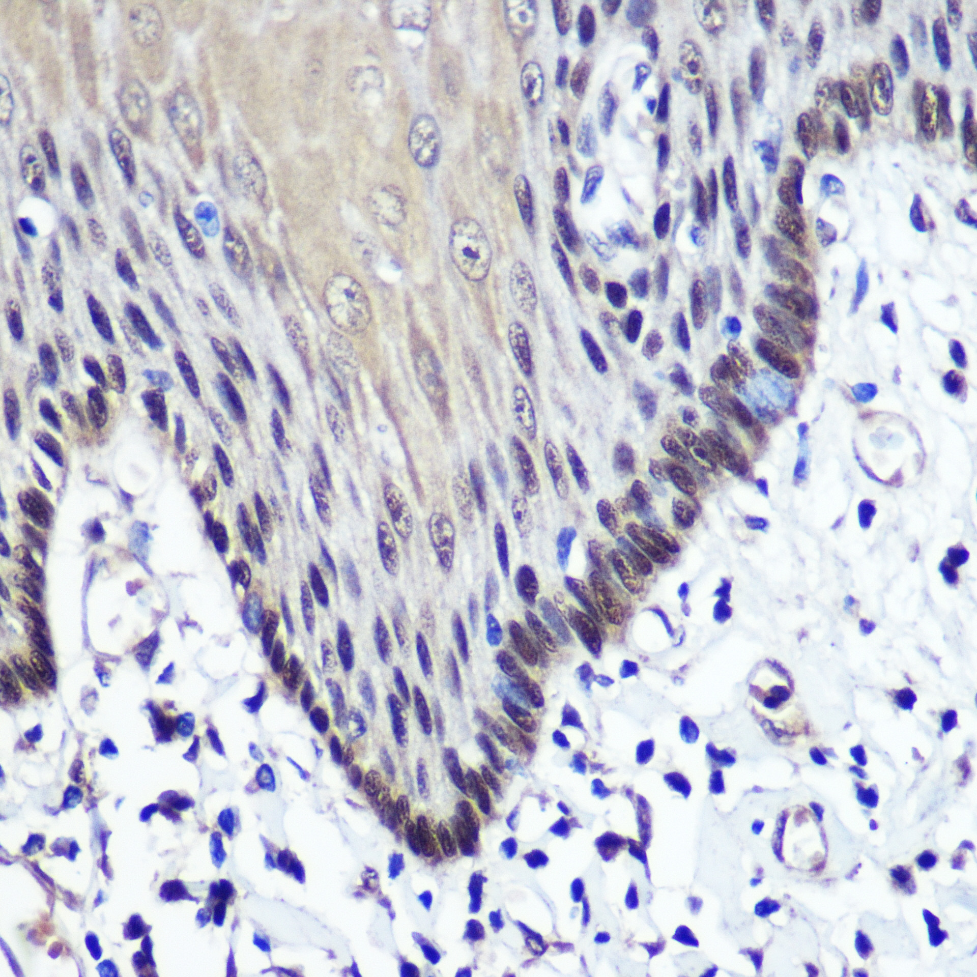 Anti-TK1 Antibody (CAB5612)