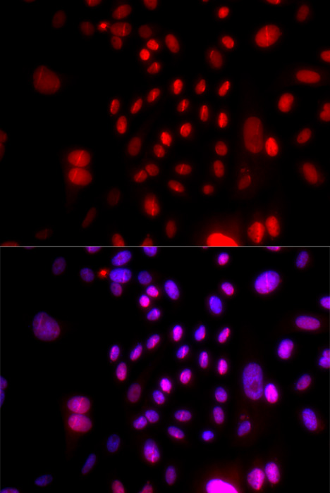 Anti-RFC4 Antibody (CAB5485)