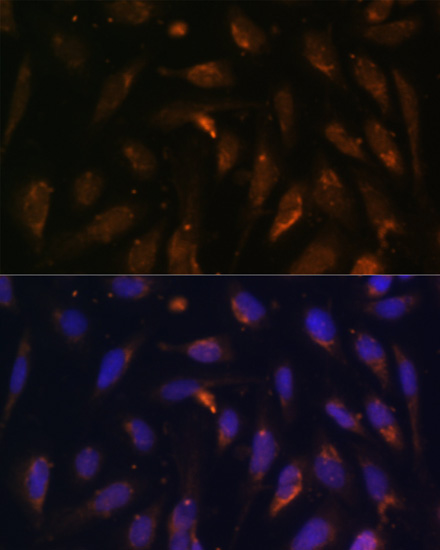 Anti-RAB8A Antibody (CAB17369)