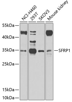 Anti-SFRP1 Antibody (CAB2911)