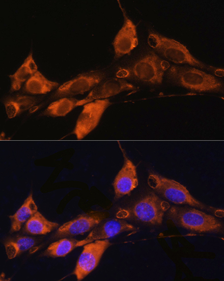 Anti-ARF4 Antibody (CAB7644)